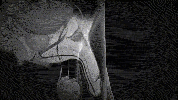 ce8d8ced02594b2daa27b22e00b65f06.gif